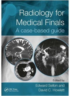 Radiology for Medical Finals: A case-based guide 