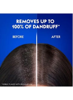 Smooth And Silky Anti-Dandruff Shampoo 390ml