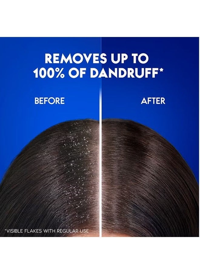 Head & Shoulders Smooth And Silky Anti-Dandruff Shampoo 390ml  - Image 1