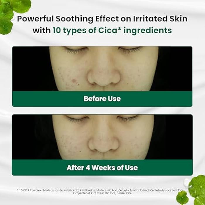 Dr. G Dr.G Red Blemish Clear Soothing Korean Moisturizer Face Cream, 70ml - Cica Cream, Korean Skin Care Moisturizer, Korean Face Moisturizer, Facial Moisturizer, Korean Skincare, K Beauty Skincare Coreano - Image 3