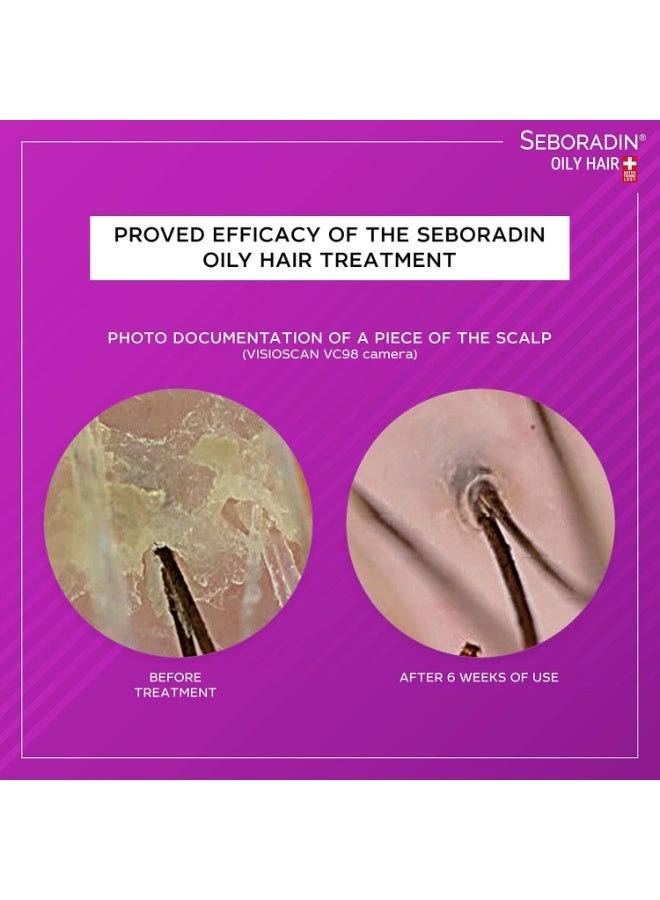 Seboradin OILY HAIR Balm for Greasy Hair 200 ml Vitamins and Natural Extracts for Thickening and Growth Natur Technology Hair and Scalp Treatment - Image 5