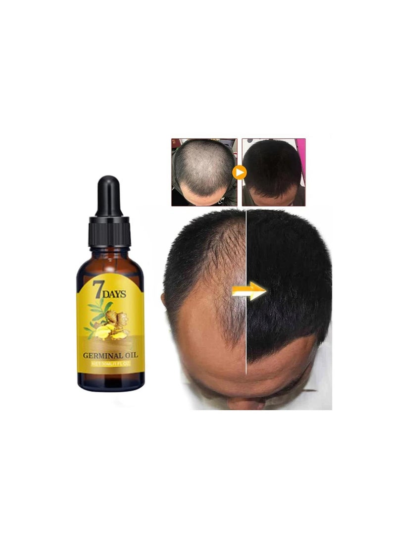 Generic - Ginger Hair Growth Serum for Scalp Massage, Hair Follicle Treatment, Hair Care - Germinal Essence Conditioner for Regrowth & Loss Treatment (1 oz) - Image 1