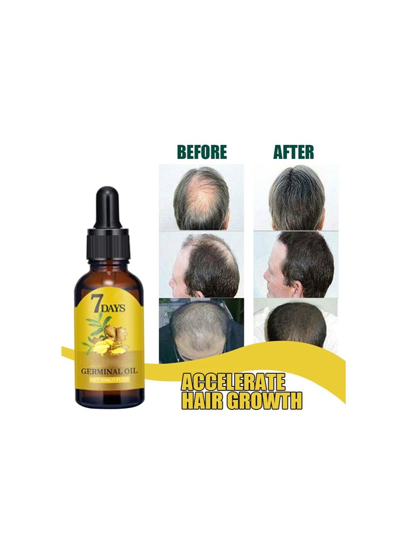 Generic - Ginger Hair Growth Serum for Scalp Massage, Hair Follicle Treatment, Hair Care - Germinal Essence Conditioner for Regrowth & Loss Treatment (1 oz) - Image 1