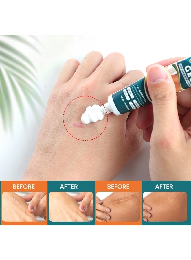 Sumifun 2026 New Formula​ Scar Gel Medical-Grade Silicone Fading Repair For Old & New Scars C-Section Scar Improve Scar Texture and Color Post-Surgery and Daily Scar Care 20g - Image 2