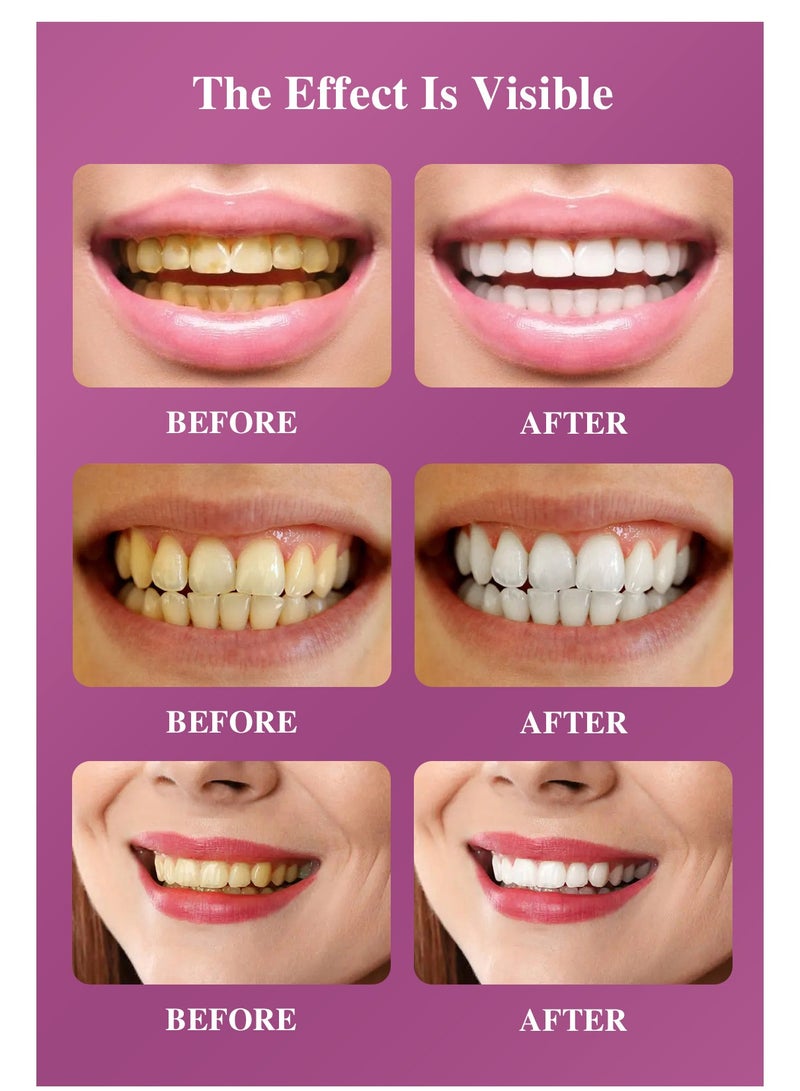 RtopR Mint Tooth Whitening Essence For Adult Brighten Teeth And Plaque Stains Removal - Image 2