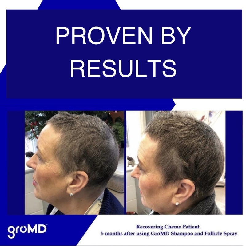 GroMD Hair Loss Serum, Hair Growth Treatment, Regrowth, Follicle Activator Spray, Argan Oil, Biotin & Caffeine, Thickening, Doctor Developed, DHT Blocking Ingredients, 60 Day Supply - Image 2