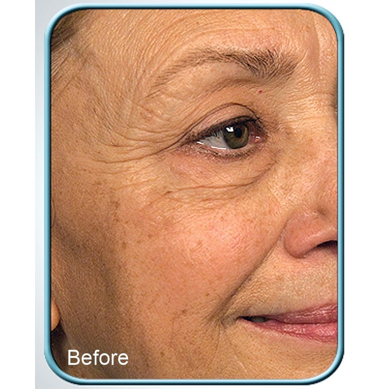 Biologic Solutions STEM CELL THERAPY CREAM BY BIOLOGIC 1oz JAR - Image 2
