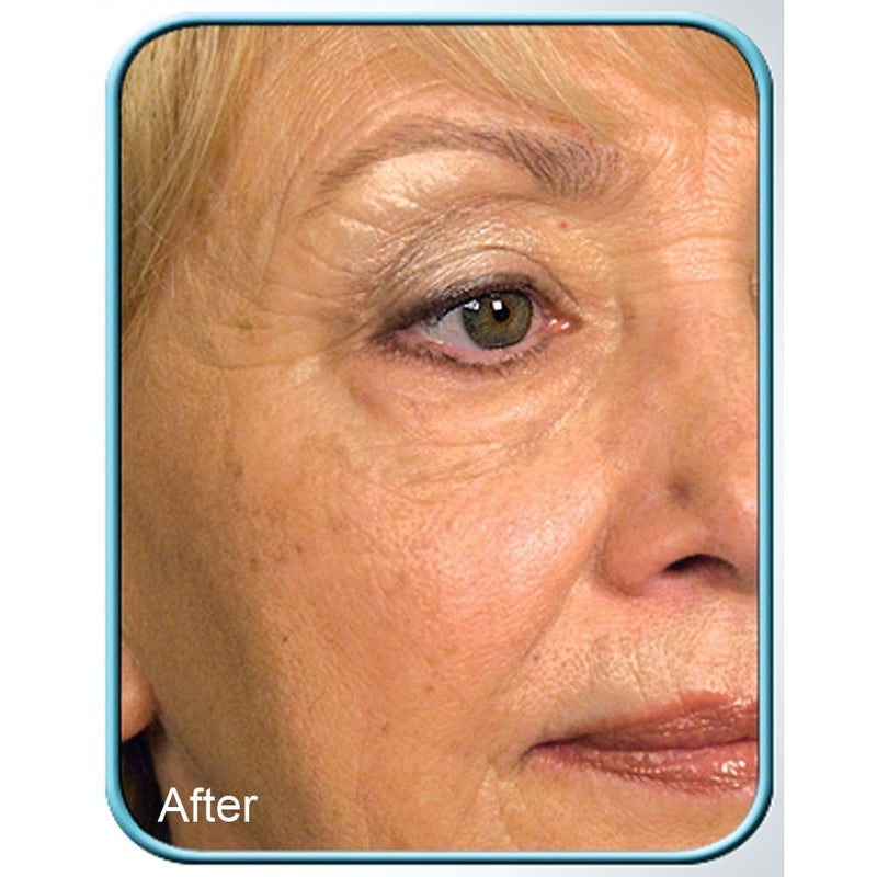 Biologic Solutions STEM CELL THERAPY CREAM BY BIOLOGIC 1oz JAR - Image 3