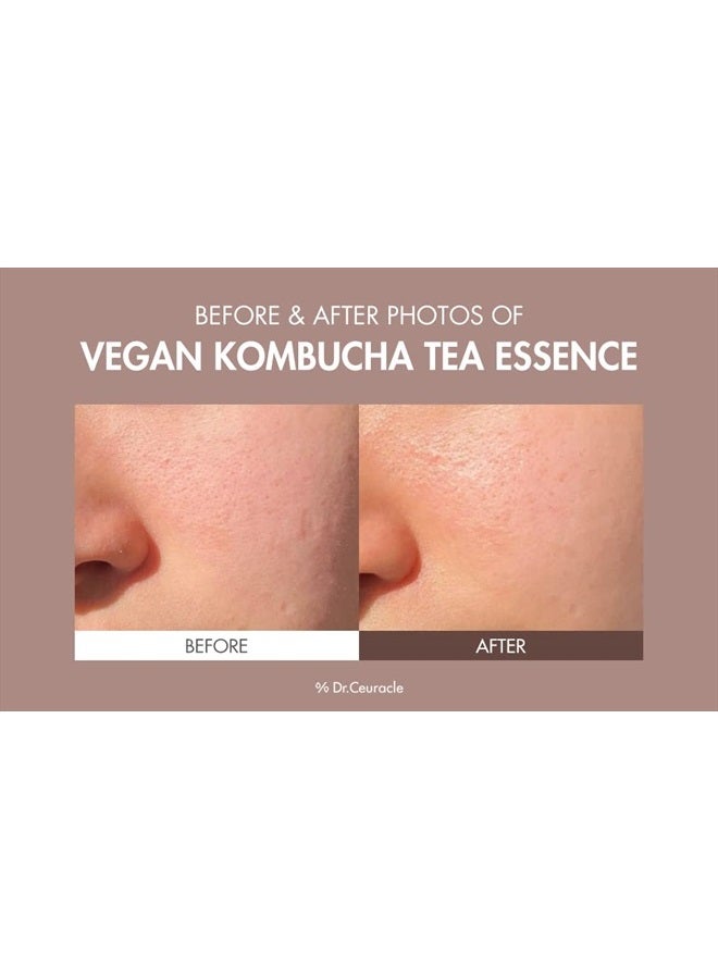 Dr.Ceuracle Vegan Kombucha Tea Special Setㅣ3-Piece Skincare Gift with Essence, Gel Cream, Lip BalmㅣHydrating, Detoxifying, NourishingㅣMade in Korea, Cruelty Free  - Image 5