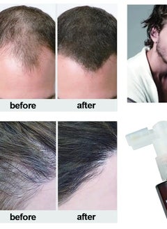 Maxcare Maxcare Revitalizing Hair Tonic Clear – Anti Hair Fall Scalp Treatment – 120ml  - Image 5