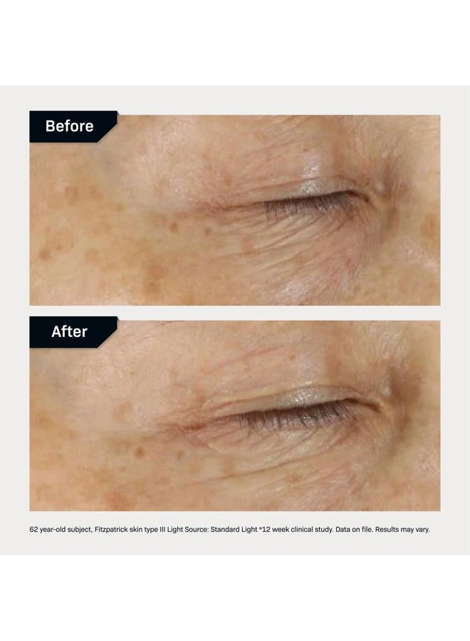 Revision Skincare D·E·J Eye Cream®, Firming and Moisturizing Treatment for Fine Lines, Wrinkles and Crow's Feet, 0.5 fl oz - Image 5