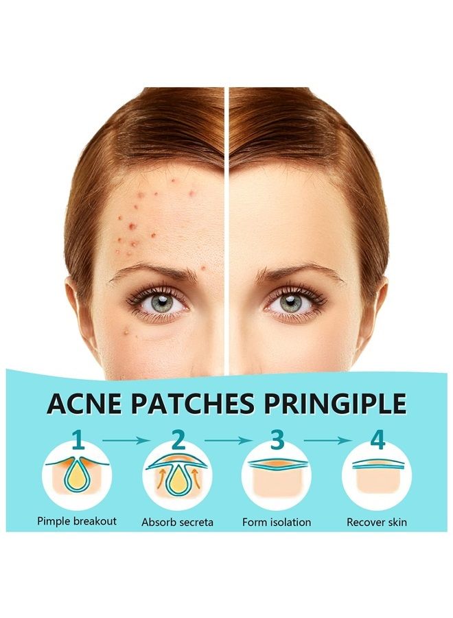 PICcircuit Pimple Patches for Face 180 Counts Hydrocolloid Acne Patches for face Invisible Zit Patches for Face Acne Spot Treatment Patch Blemish Patches Cover Patches Stickers - Image 1
