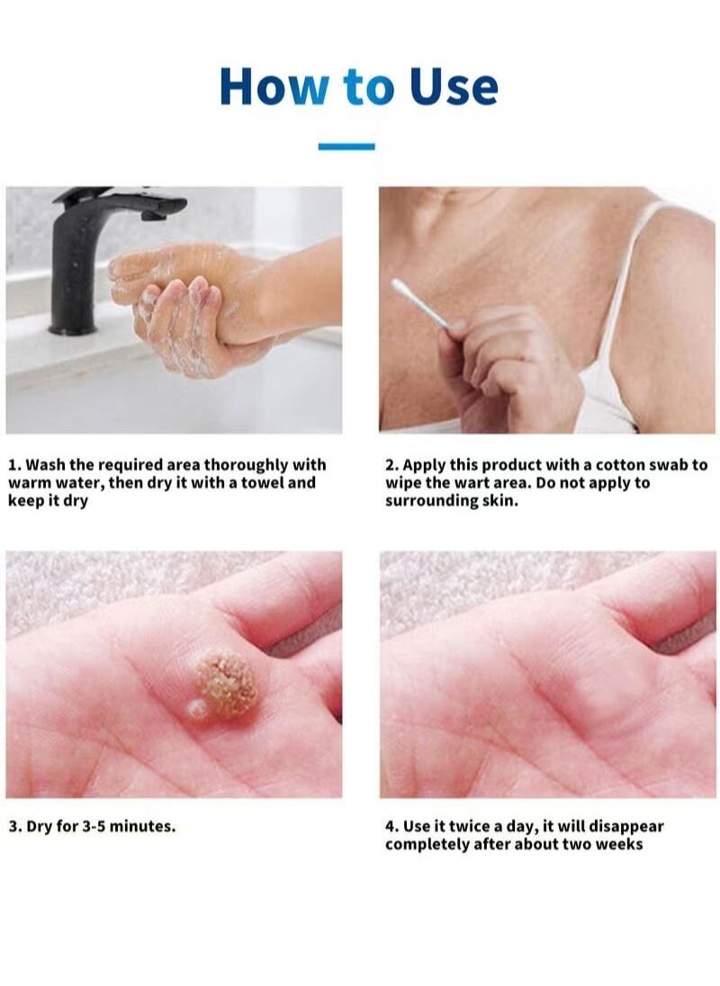 HEALMUSZ - Wart Remover Safe and Effective Natural Herbal Formula High Absorption Fast Acting Stop Wart Regrowth Non Irritating Wart Remover for All Kinds of Skins Type 10ml - Image 1