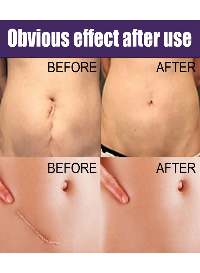 إيلهو 1 حقيبة / 8 قطعة سليكوون وشاح - Image 5