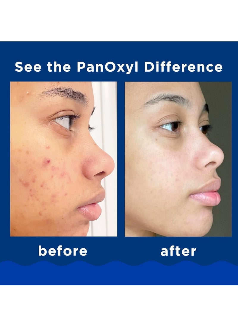 Generic - Panoxyl Acne Foaming Wash Benzoyl Peroxide 10% 156g - Image 1