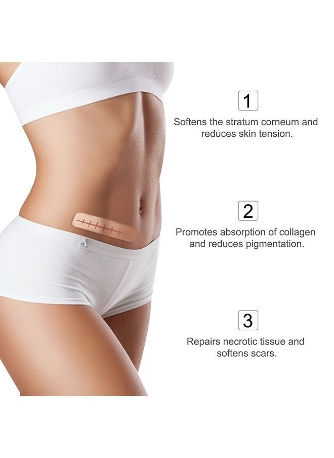Elaimei - Silicone Scar Sheets (1.6” x 120”Roll-3M), Silicone Scar Tape Roll, Scar Silicone Strips, Reusable, Professional Scar Removal Sheets for C-Section, Surgery, Burn, Keloid, Acne et - Image 1
