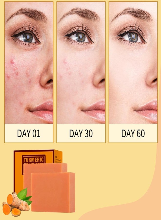 YAFUSIPE Turmeric Kojic Soap for Face and Body 200g/7OZ Facial Oganic Tumeric Soap for Acne Hand Bath Bar Curcuma Bars Face Wash Facial Cleanser for Blemishes Pimples Dark Even Skin Tone Spots Bright - Image 2