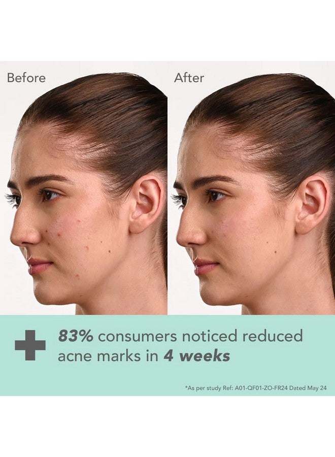 Lotus Dermabotanics Kojic Acid + Multi Berry Hi-Dose Serum | Reduces Pigmentation & Dark Spots | Calms Redness | Made With Dermatologists | Non-Irritating | Ph 5.5 | Suitable For Sensitive Skin | 28Ml - Image 4