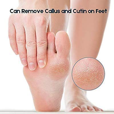 Topinon Lava Pumice Stone for Foot Callus Knees Callus Remover for Feet & Hands - Pedicure Tool Exfoliation to remove dead skin - 2 Pcs - Image 5