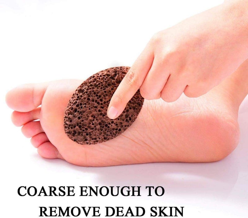 Topinon Lava Pumice Stone for Foot Callus Knees Callus Remover for Feet & Hands - Pedicure Tool Exfoliation to remove dead skin - 2 Pcs - Image 3