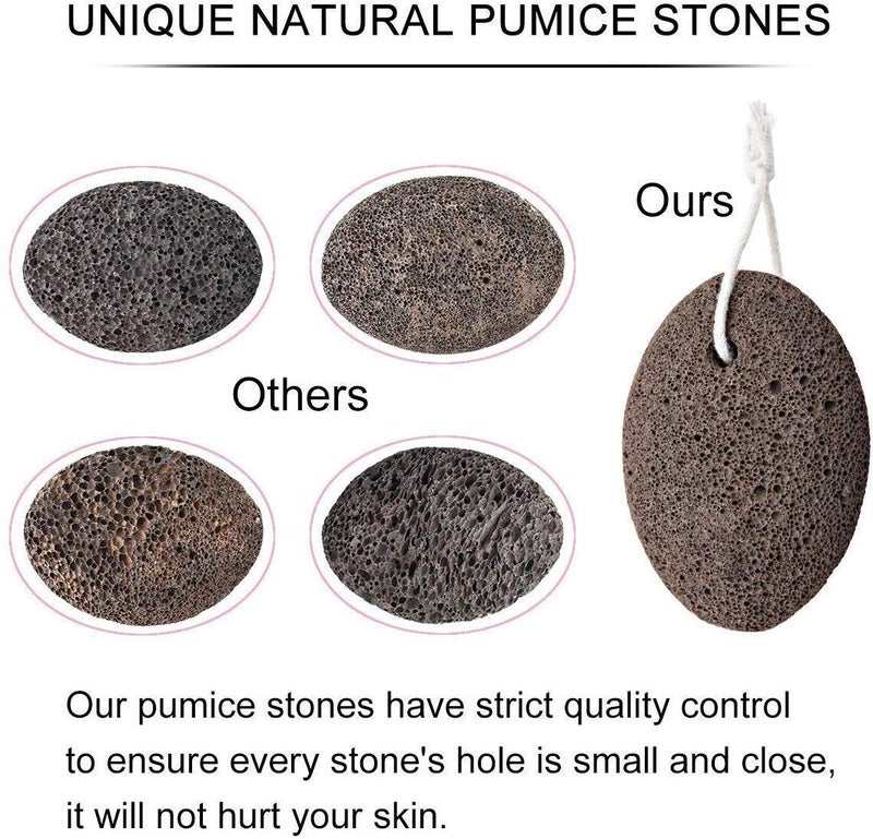 Topinon Lava Pumice Stone for Foot Callus Knees Callus Remover for Feet & Hands - Pedicure Tool Exfoliation to remove dead skin - 2 Pcs - Image 2