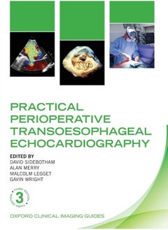 Practical Perioperative Transoesophageal Echocardiography 