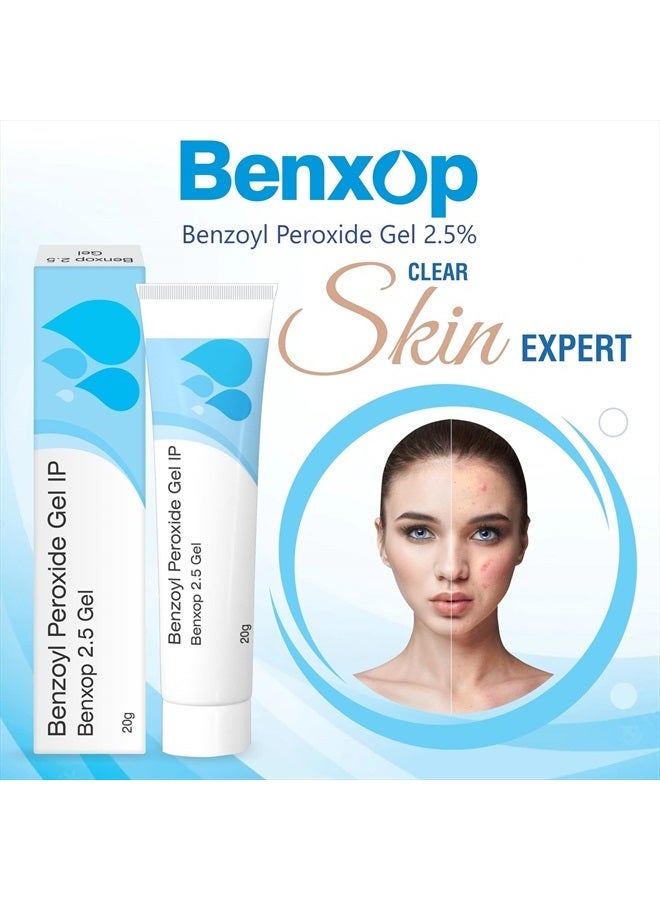 Salve كريم بنكسوب بنزويل بيروكسيد 2.5% لعلاج حب الشباب 20 جرام (0.70 أونصة سائلة) - Image 4