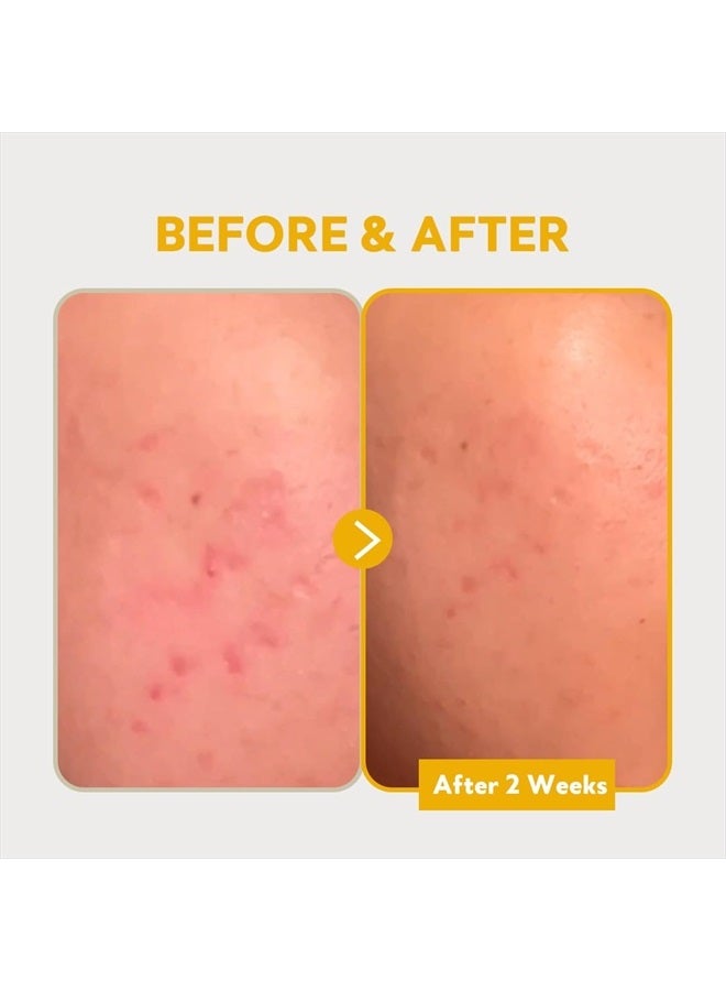 TIRTIR PURE VITAMIN C 24% SERUM 30ml  - Image 5