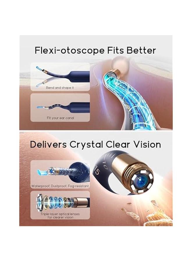 Bebird Bebird Earsight Plus R37R Ear Cleaning Camera Wax Removal Tool kit, Flexible Ear Scope Otoscope Camera Light, Visual Ear Picker Wireless Earwax Remover Tweezers for Adults & Kids - Image 3