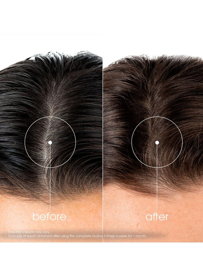 Klorane Quinine Bio Strengthening Anti-Hair Loss Shampoo 100ml - Image 4