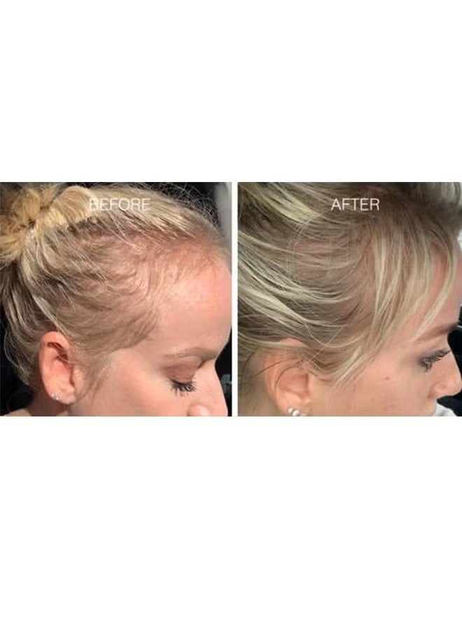 EELHOE HAIR GROWTH SPRAY BY38%  AFTER 14 DAYS - Image 3