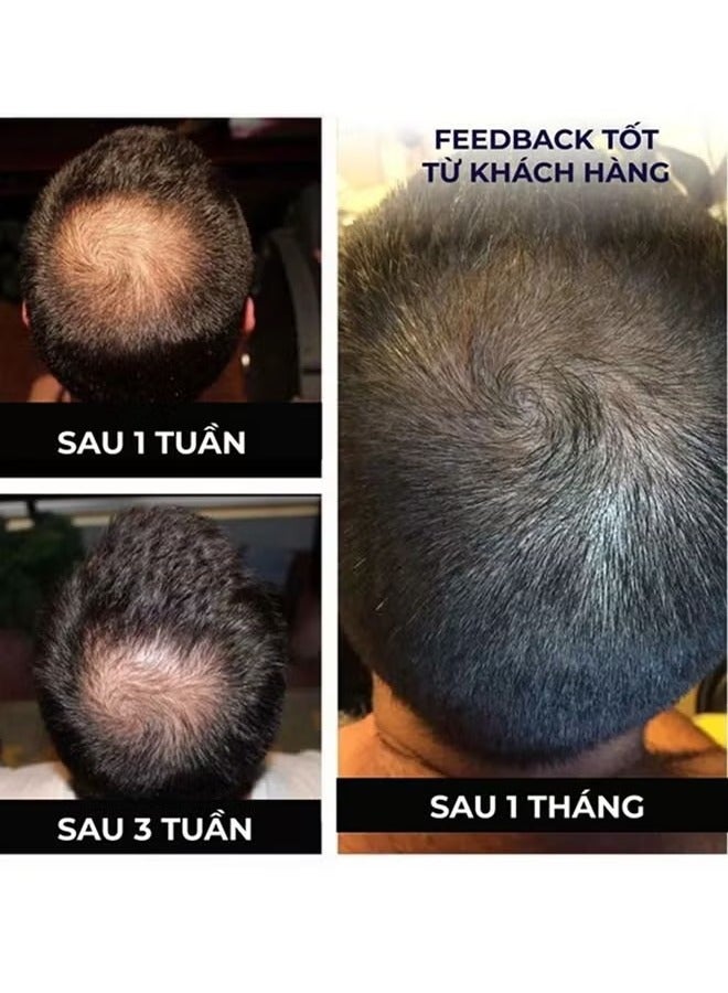 EELHOE HAIR GROWTH SPRAY BY38%  AFTER 14 DAYS - Image 2