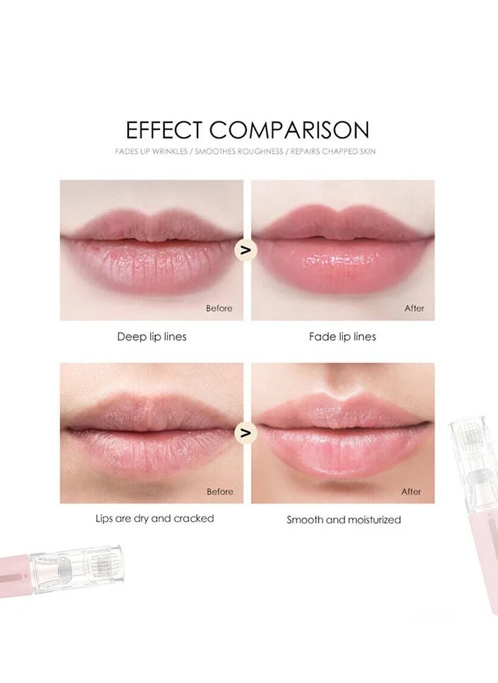 Pretocter - 0.25mm Lip Care Essence Roller, Essence Applicator, Beard Hair Growth Essence Roller（Pink） - Image 1