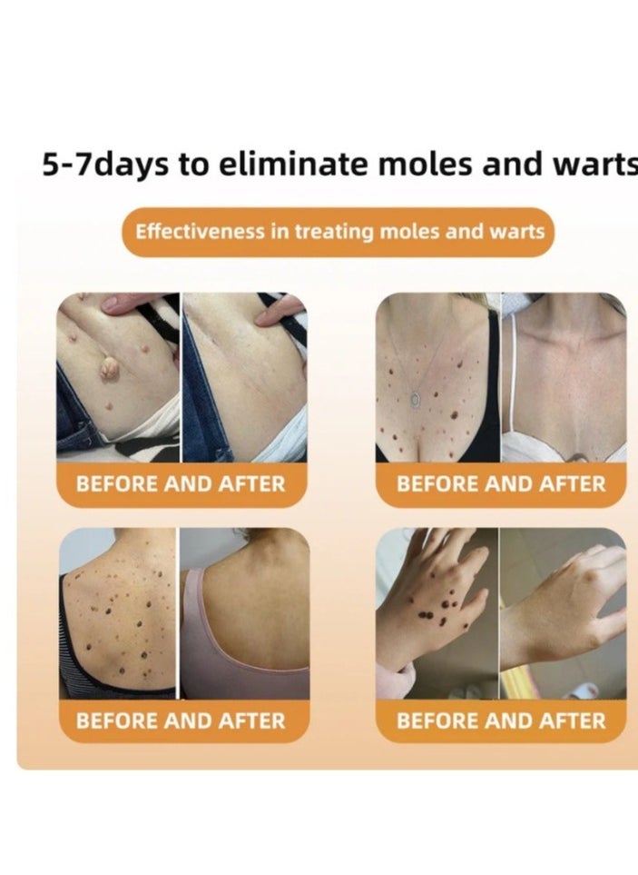 PHANSTA Venom Treatment Cream, New Professional Bee Venom Repair Cream, Bee Venom Cream for All Parts of The Body (1 Pack) 2024 New Bee Venom Treatment Cream - Image 4