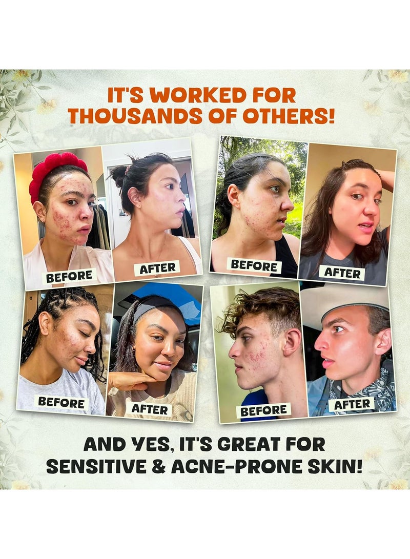 ATRJSZ Whipped Beef Tallow and Honey Balm Moisturizer for Skin, Face, Lips, Body - Unscented - Image 3