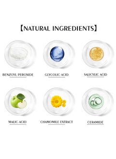 CARVENCHY 3 Step Acne Treatment 30 Day Complete Acne Skin Care Kit  - Image 4