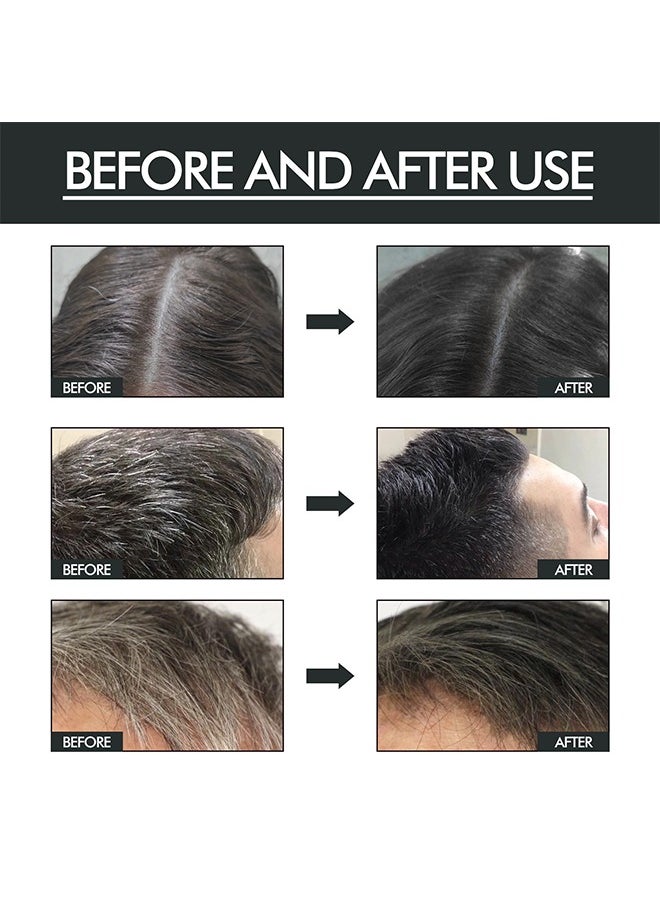 EELHOE - Hair Darkening Spray 100ml - Darkenal Anti Greying Hair Serum, 2% Greyverse, Melanin Synthesis, Naturally Pigmented,Hair black,Thinning And Shiny, No Synthetic Colours - Image 1