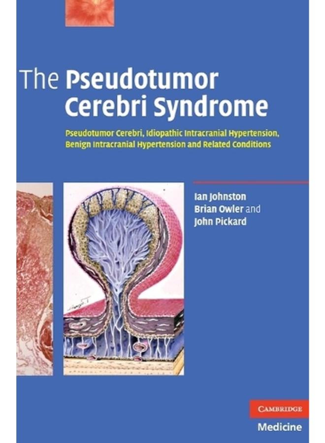 متلازمة الورم الكاذب في الدماغ