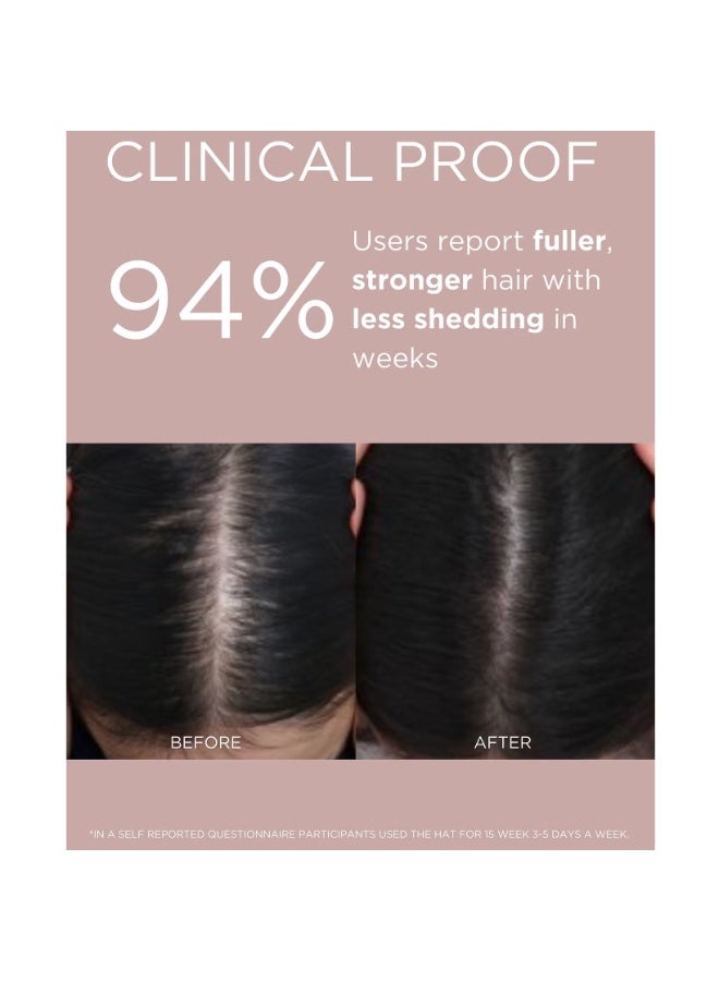 سولاريس لابوراتوريس نيويورك قبعة Solaris Labs NY Hair Boost Red LED الداعمة لنمو الشعر - Image 2