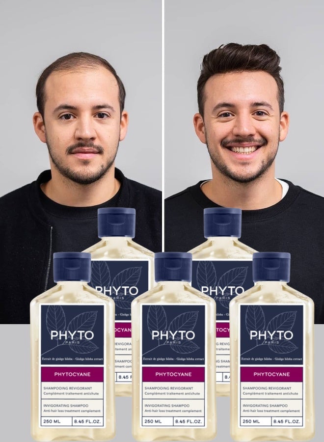 Phyto 5 Pieces Phyto Paris Hair Loss Shampoo Women And Men Invigorating 250ML - Image 1