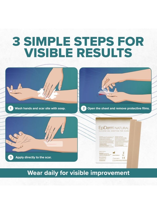 PROSIL EpiDerm Long Strips Natural Silicone Scar Sheets – Soft, Flexible & Reusable Scar Sheets - Scar Treatment for Tummy Tuck, C-Section & Surgery Scars - Conforms to Body Contours - 1.4" x 11.5", 1 Pair - Image 2