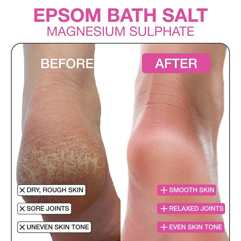 Soulflower Epsom Salt for Foot Bath  Body Spa Swelling  Soreness Relaxing Muscle Pain Relief  100 Pure USP Grade Epsom Salt Pure Lavender Essential Oil 350g Pack of 1 - Image 2
