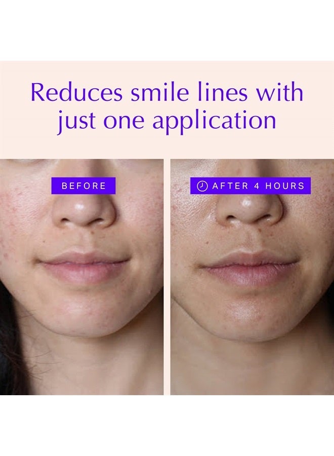 BLUMBODY Face Wrinkle Patches - Anti Wrinkle Facial Patches to Smooth Smile Lines - Non-Silicone Face Patches Wrinkles Tape for Fine Wrinkles between Eyes & Face - For Overnight Wrinkle Use - Image 2