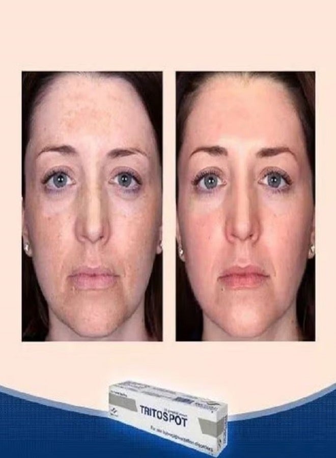 EVAPHARMA Tritospot Tropical Cream For Hyperpigmentation Problems for Men and Women - Image 4