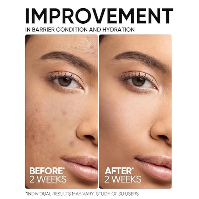 SKINTIFIC 5X Ceramide Barrier Repair Serum for Dry & Sensitive Skin Barrier Repair with Ceramide, Centella and Hyaluronic Acidx, Soothes Sensitive Skin, Reduces Redness & Strengthens Skin Barrier - Image 4