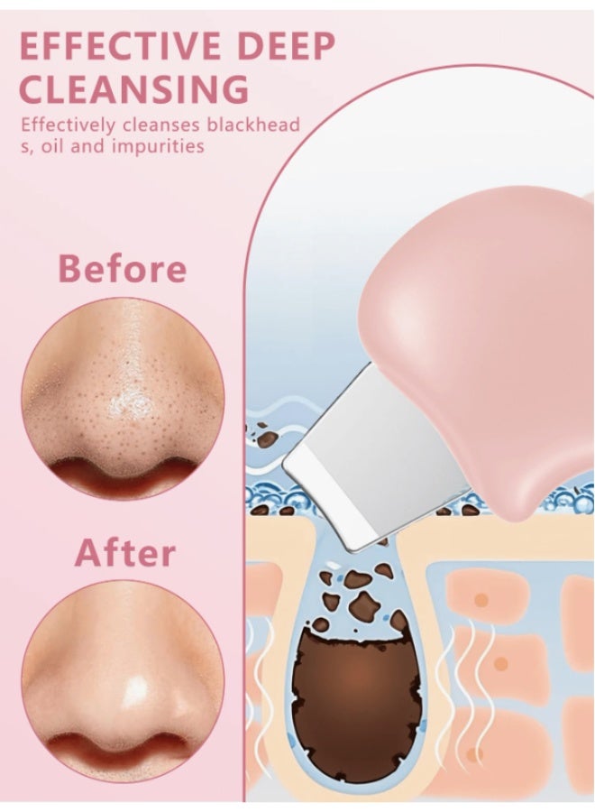 Ultrasonic Skin Scrubber Face Scraper Tool - Professional Blackhead Remover & Deep Pore Cleansing Tool - Image 4