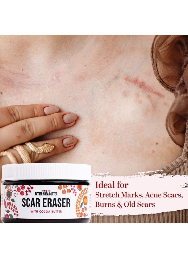 Better Shea Butter Scar Eraser Cream : For Stretch Marks Acne Scars Burns Old Scars : Designed W Zero Synthetic Ingredients Or Preservatives (4 Oz)  - Image 3