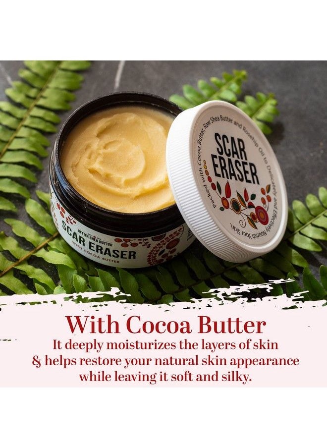Better Shea Butter Scar Eraser Cream : For Stretch Marks Acne Scars Burns Old Scars : Designed W Zero Synthetic Ingredients Or Preservatives (4 Oz)  - Image 4