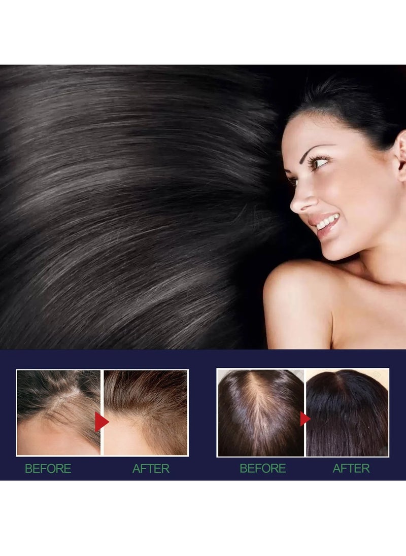 OUHOE - Hair Growth Spray, Hairgrowth Formula Serum Spray, Nourishing Moisturizing Scalp Treatment Anti Hair Loss Oil, Hair Growth Essence For Thicker Longer Hair - Image 1