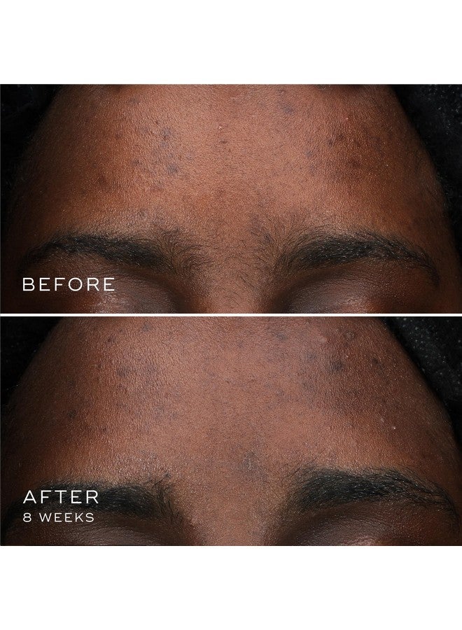 ميديك8 مصل أوكسير الببتيدات يستهدف مصحح البقع الداكنة مع الببتيدات المزدوجة، مصل التنشيط الطازج للوجه، يوحد لون البشرة وتغير اللون، لطيف على البشرة الحساسة، 0.3 أونصة - Image 5